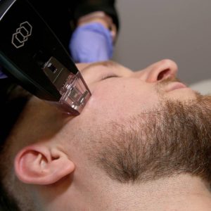 Man Having a Morpheus 8 facial at The Men’s Grooming Salon