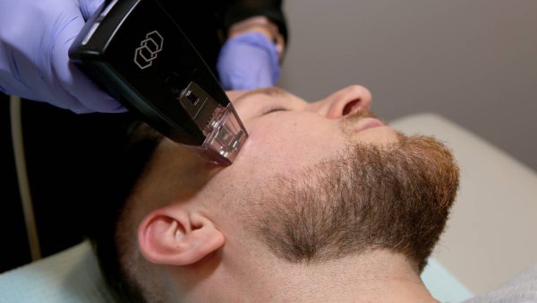 Man Having a Morpheus 8 facial at The Men’s Grooming Salon