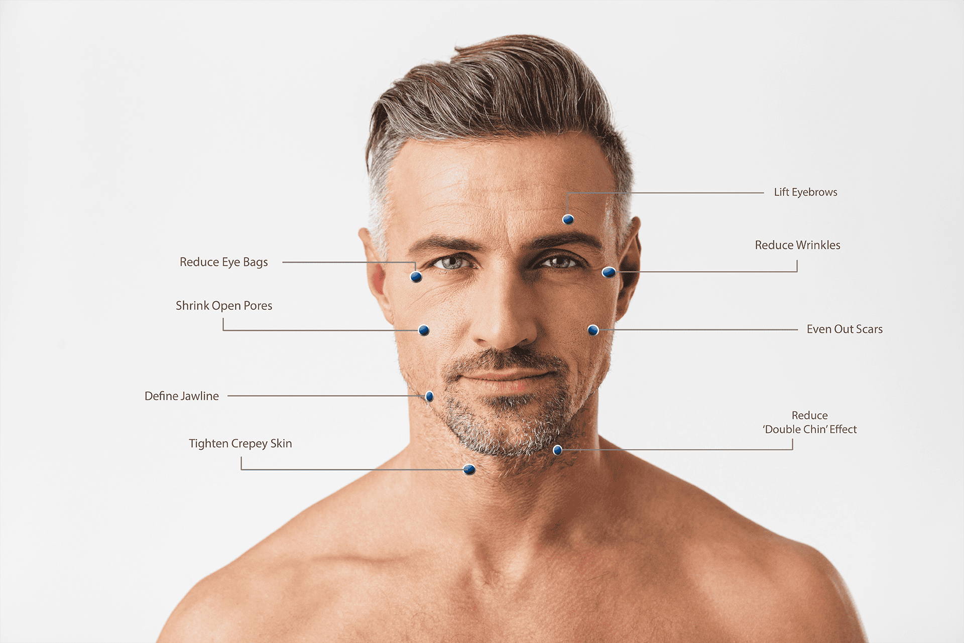 man having microneddeling treatment on face